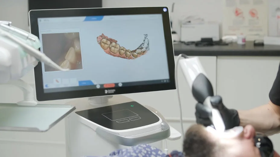 Dentist using a handheld digital intraoral scanner while the 3D scan of the patient's teeth appears on screen