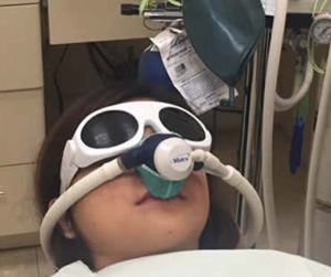 All About Laughing Gas