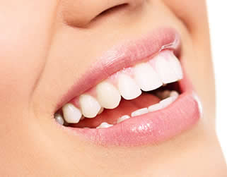 What is Laser Teeth Whitening?